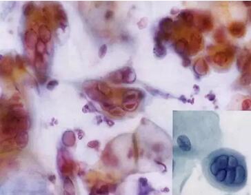 ���(l��i)ϴ���ӣ��������ךW���M(j��n)�ھ�ϴ�O���ꑌ�������Ҽ�